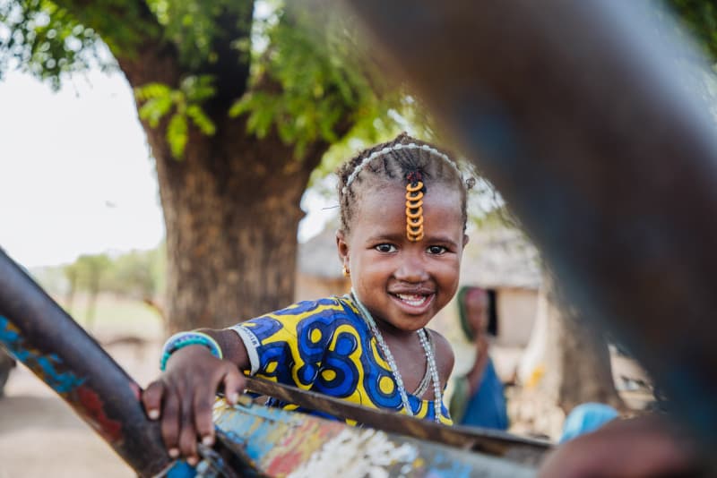 Sénégal : victime de malformation des lèvres, une fillette retrouve le sourire grâce à Mercy Ships
