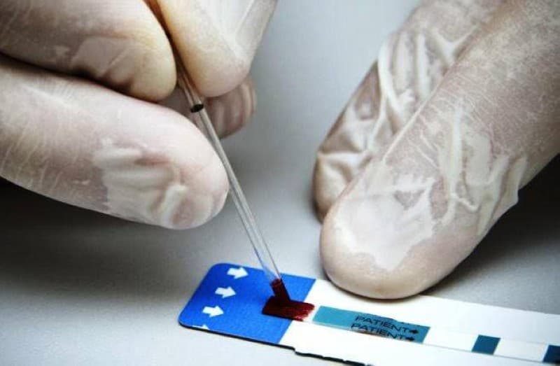 Côte d’Ivoire : la lutte contre le VIH progresse, mais le retrait des aides américaines suscite des inquiétudes